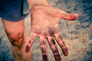 Personalized Kozmetika Solutions for Sensitive Skin